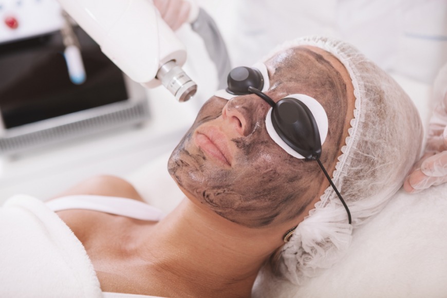 Botox and carbon laser in Dubai